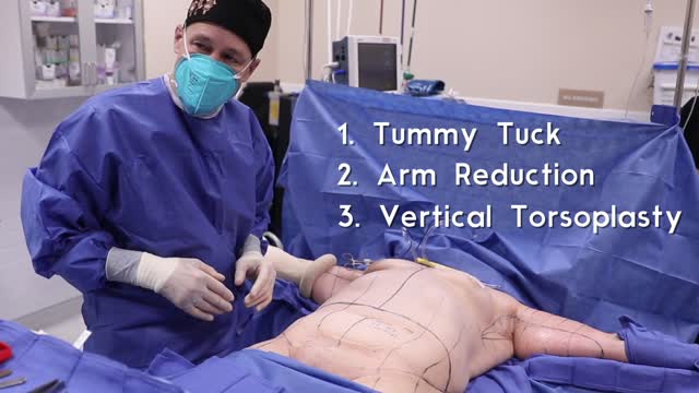 Tummy tuck, Arm Reduction, Axillary Z-Plasty, and a Vertical Torsoplasty after 100 lb Weight Loss