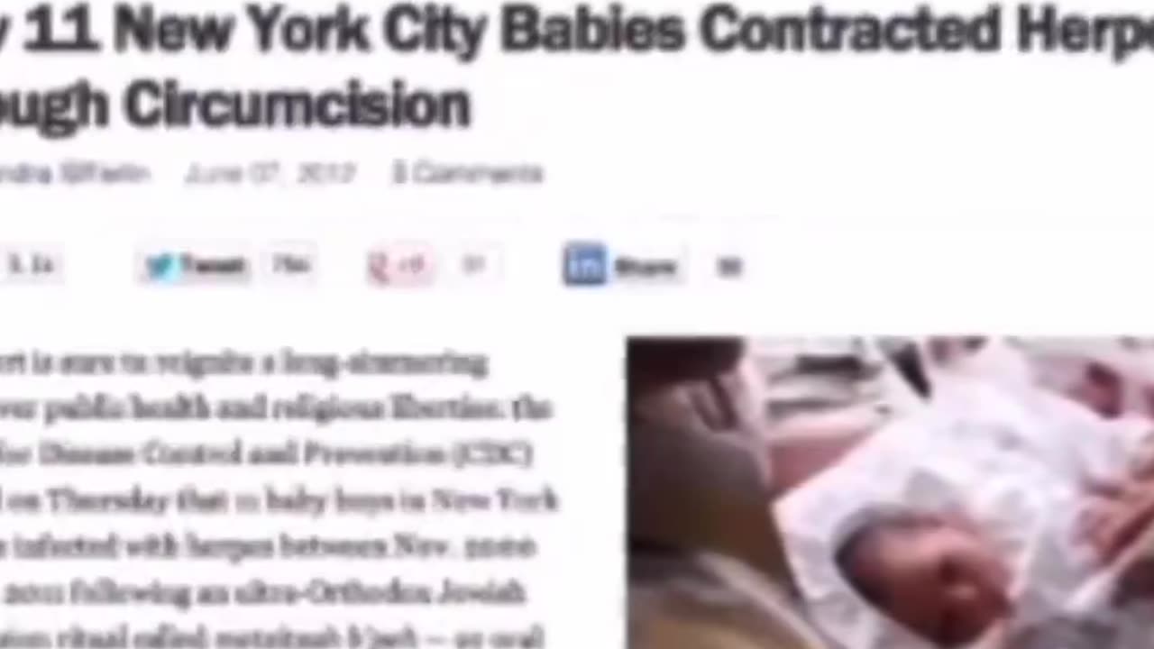 Rabbi ritual with newborns leads to Herpes