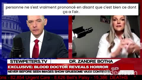VOSTFR- Analyse sous microscope du V* de J&J et du sang de ses patients