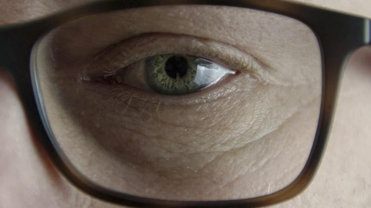Public Eyes... Can't Escape