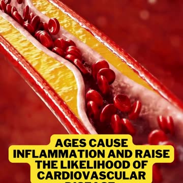 Deep Fried Foods at Major Contribute to Heart Disease.