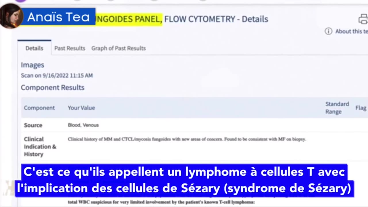 Covid vaccine SIDE EFFECTS. Testimony of a Victim: