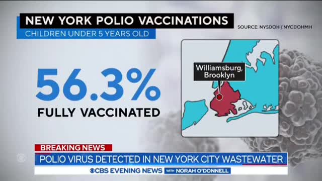 Polio virus detected inNYC wastewater