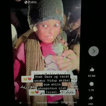 Child’s face burned with white phosphorus