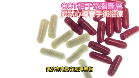 OCT相干電腦斷層 冠狀心導管手術治療