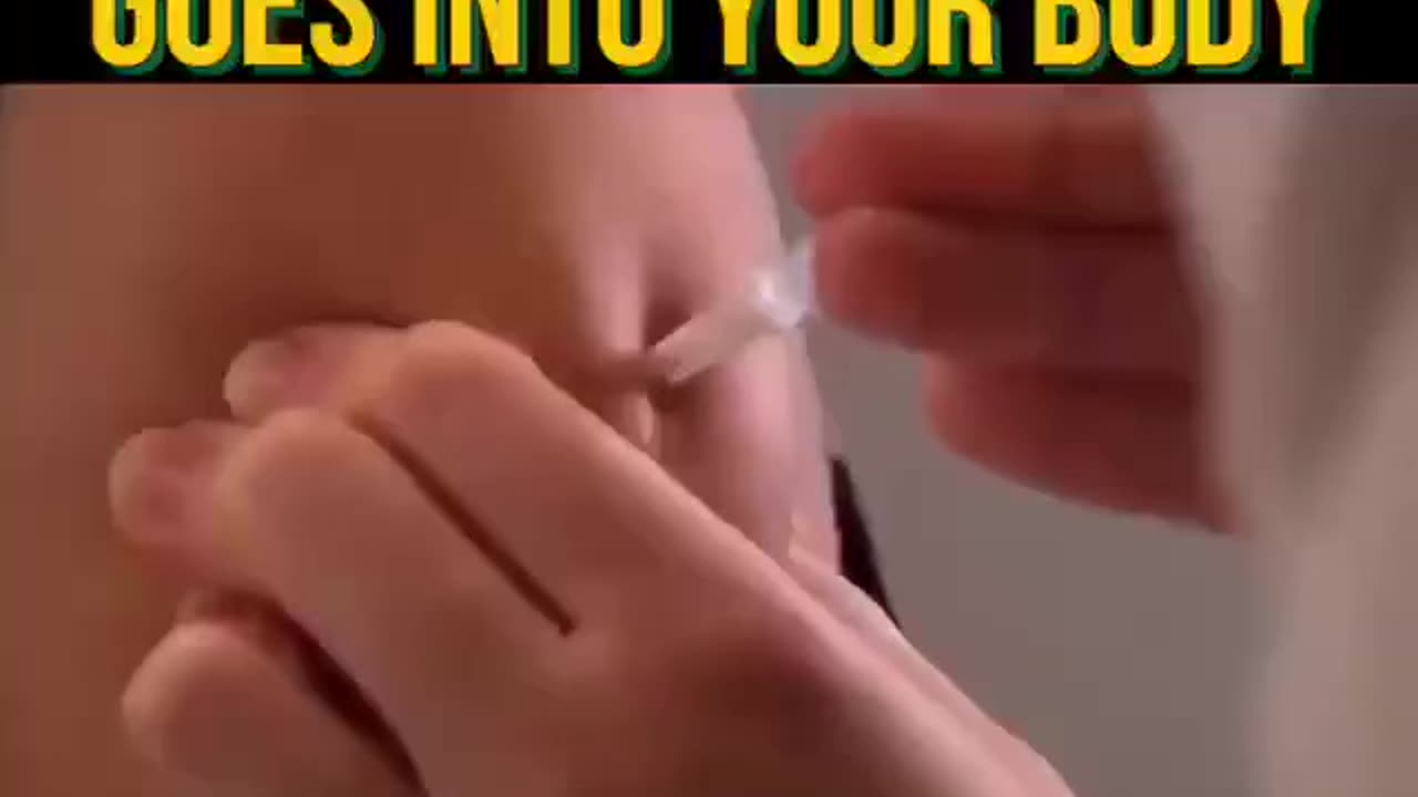Where Toxic Aluminum In JABS Goes In Your Body !!!