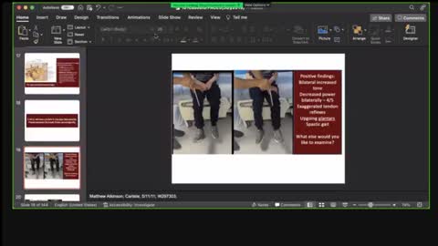 ST3.A 49 year old man with falls Punekar