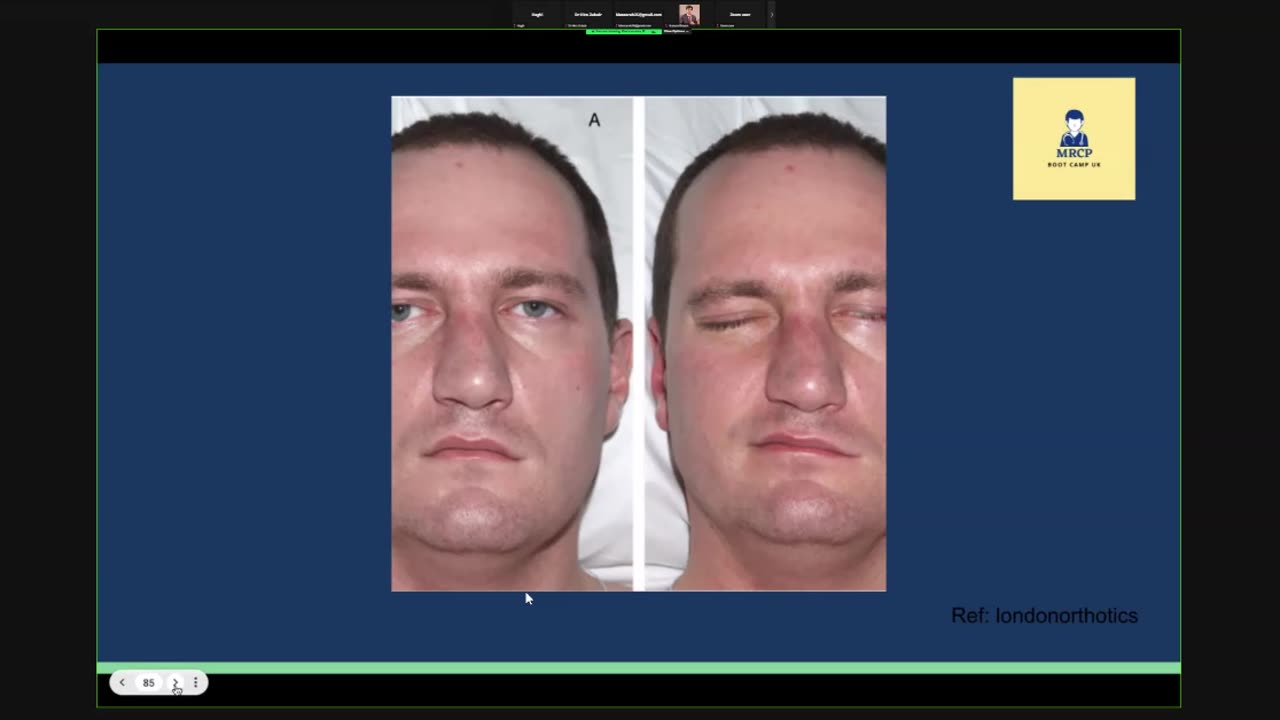 ST3.Examine the cranial nerves of this patient