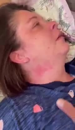 Moderna side effects