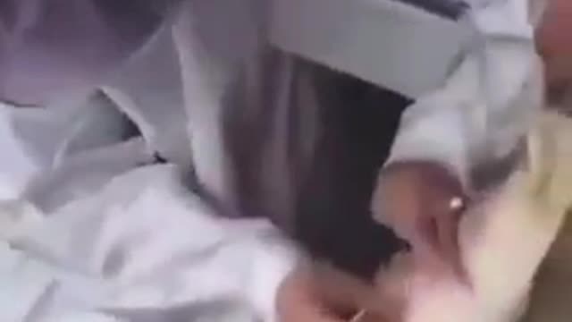 HISTERIA: PCR a patos