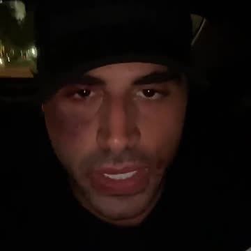 ZHERKA GOT JUMPED😱