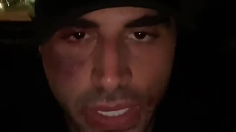 ZHERKA GOT JUMPED😱