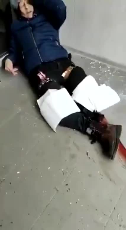 Nice try Ukraine crisis actors You might need a second cut to make it look real