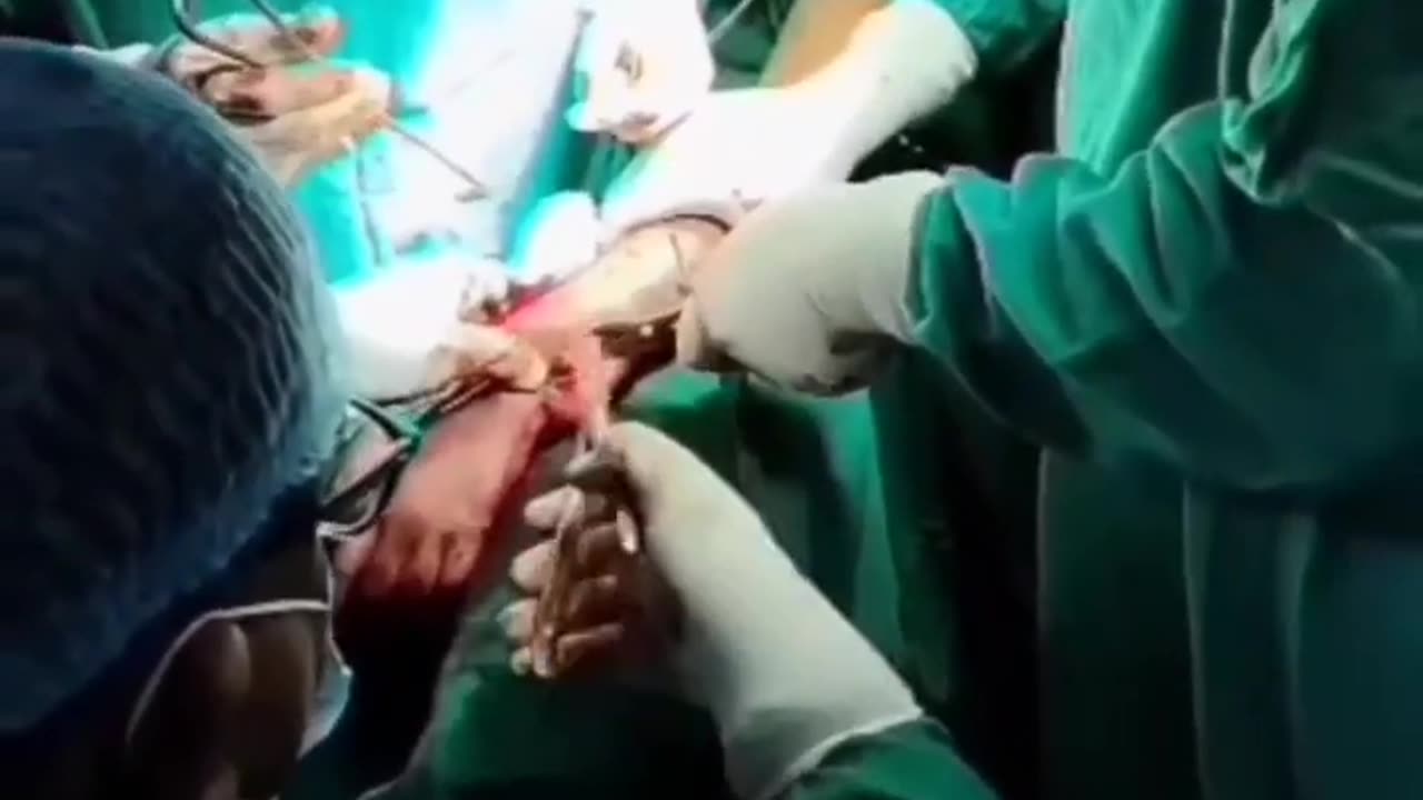 How is the surgery