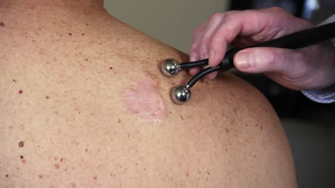 BCA Training - Dr. Traver - Treating Scars