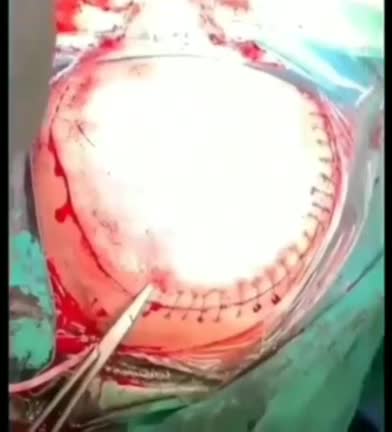 VIDEO SUBIDO POR EL DR. WILFREDO STOKES