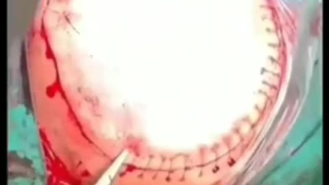 VIDEO SUBIDO POR EL DR. WILFREDO STOKES