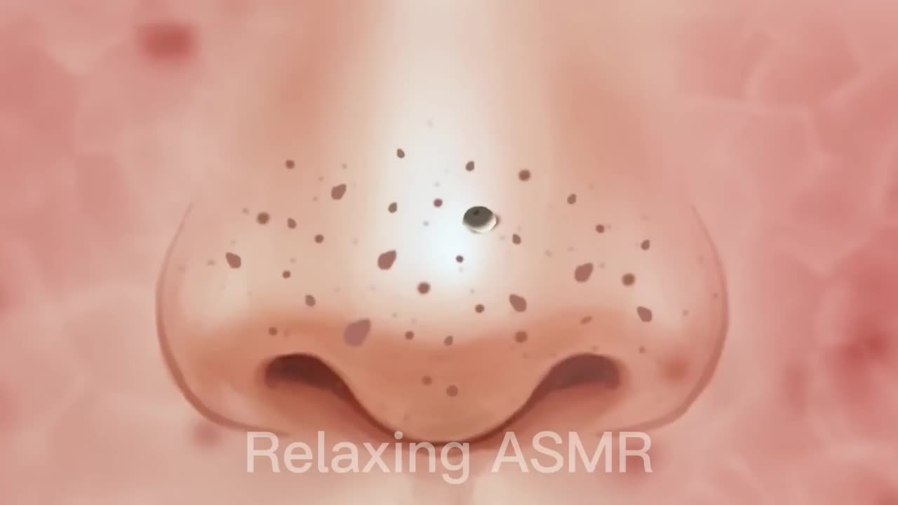 ASMR pimple blackhead Removal | Videos in 2023 |