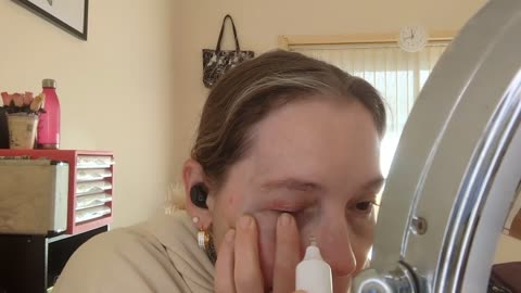 Fibroblasting My Upper Lids