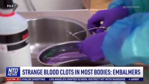 Mysterious Fiber Clots Are Being Found in Corpses Recently