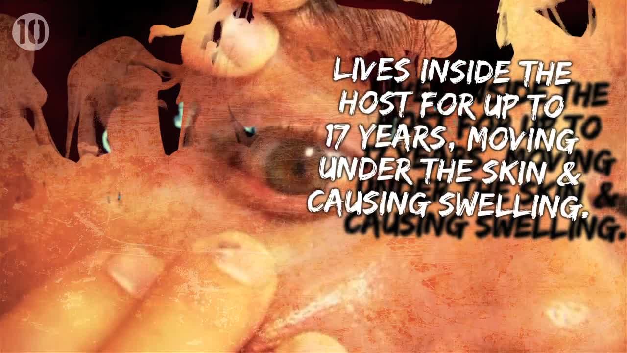 10 Horrifying Parasites That Might Be Living Inside You