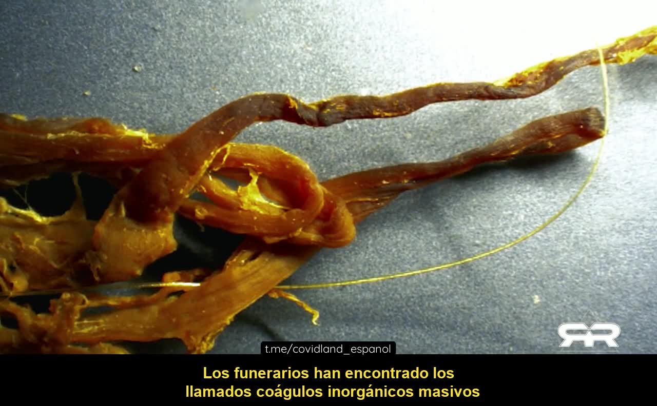 Vacunas mortales contra el COVID y la misteriosa espiral descendente