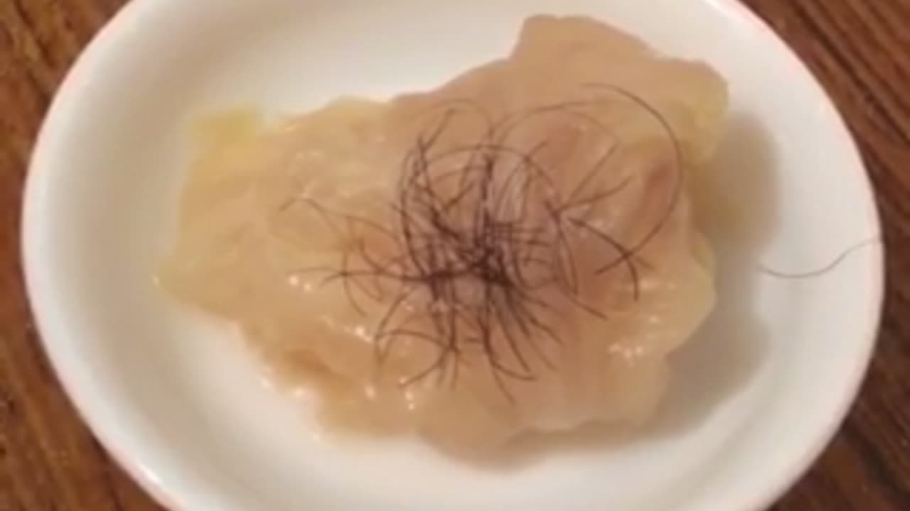 Boiled Cabbage Recipe Hairy 18042023 🆂🆄🅱🆂🅲🆁🅸🅱🅴 ⚠️Viewer discretion is advised⚠️