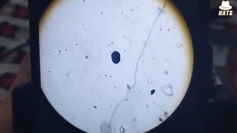 Pfizer vaccine studied under the microscope. The results are truly shocking.
