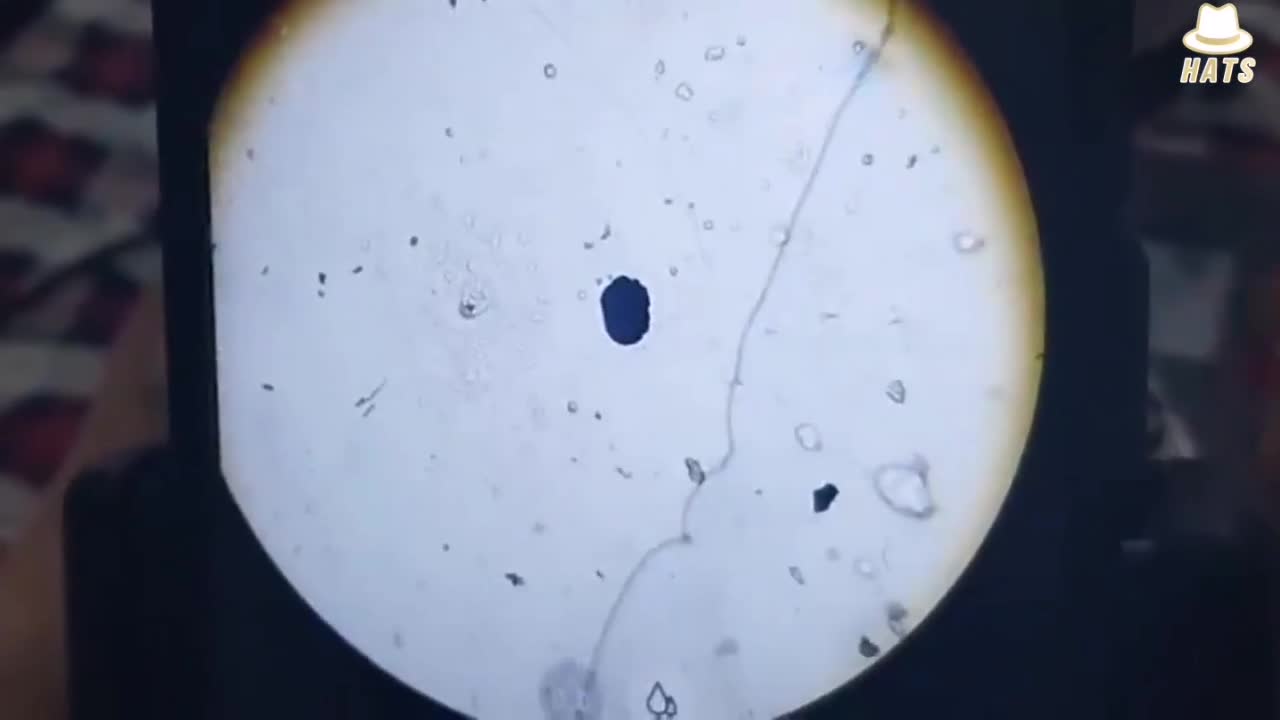 Pfizer vaccine studied under the microscope. The results are truly shocking.