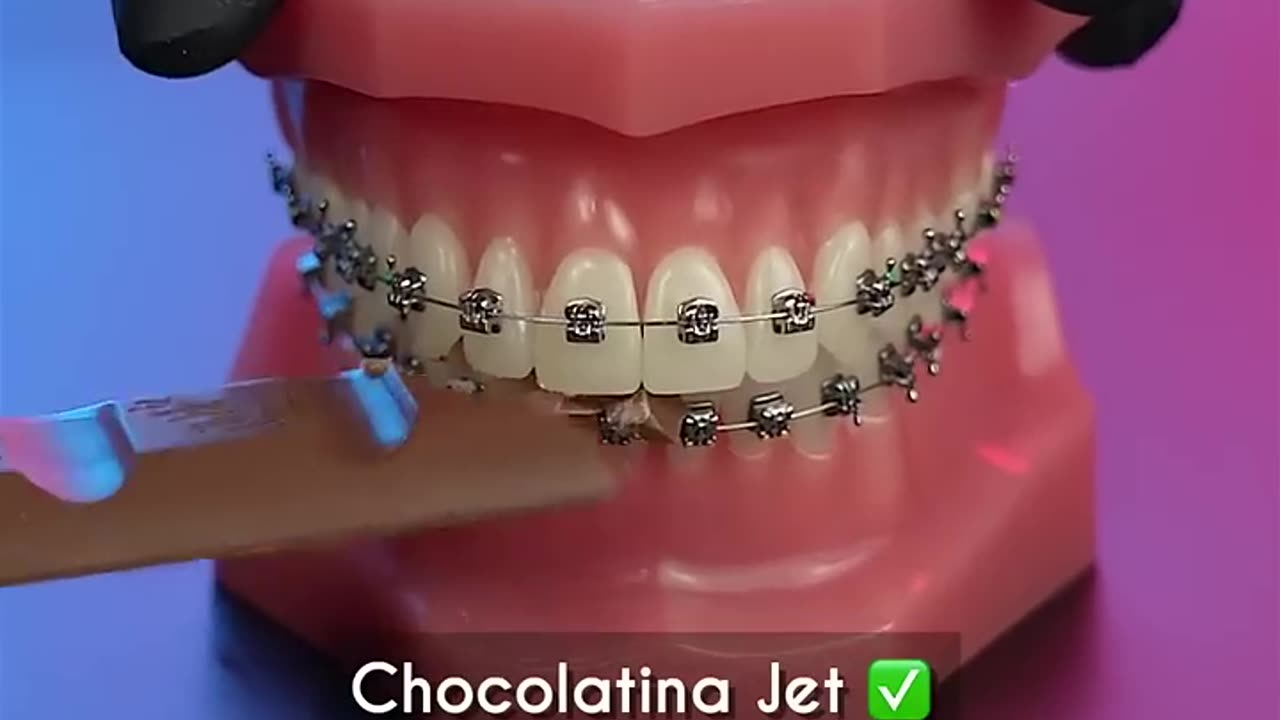 ¿Que comer con brackets en 🇨🇴 ? - Odontología Láser #Shorts