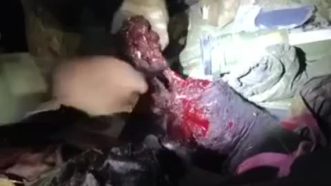 Russian Surgery