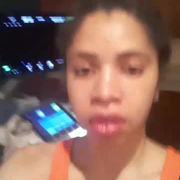 Hair for surgery? Part 1!