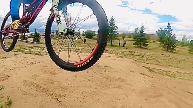 Sherwood Park Dirt Jumps: Strathcona County Bike Skills Park