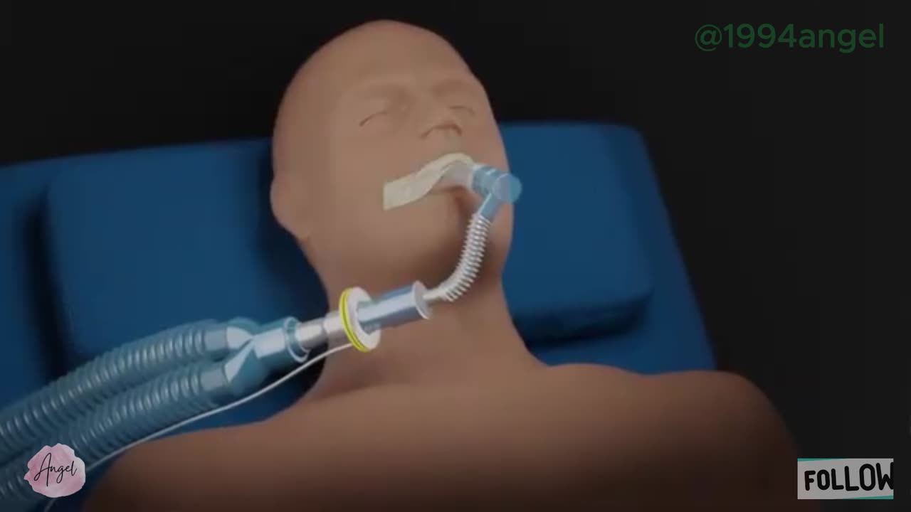 Basics of ventilation_ Deadspace in breathing