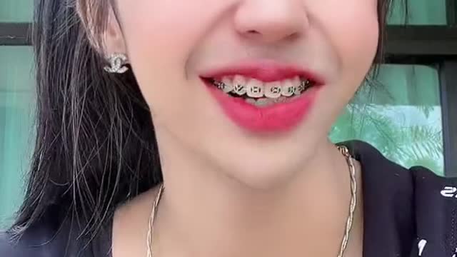 ไปเปลี่ยนยางฟันสีอะไรดีค่ะ ช่วยเลือกหน่อยทุกคน #อะต๋อม #foryou