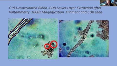 Evidence of Crimes Against Humanity - Darkfield Blood Microscopy