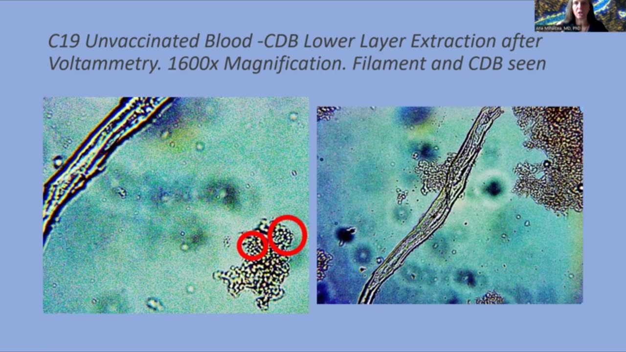 Evidence of Crimes Against Humanity - Darkfield Blood Microscopy