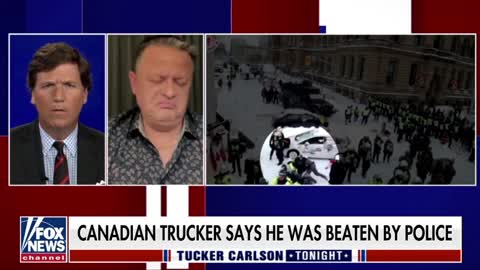 Canadian trucker speaks to Tucker Carlson about Ottawa police violently assaulting him.