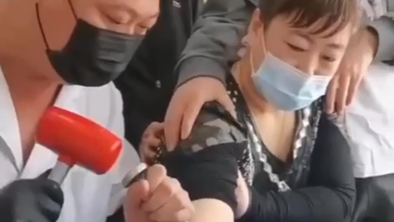 Amazing way of Treatment 😯 神奇的治疗方法