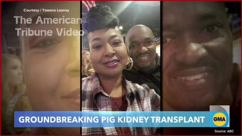 Watch: Woman Gets “Second Chance” from Pig Kidney Transplant