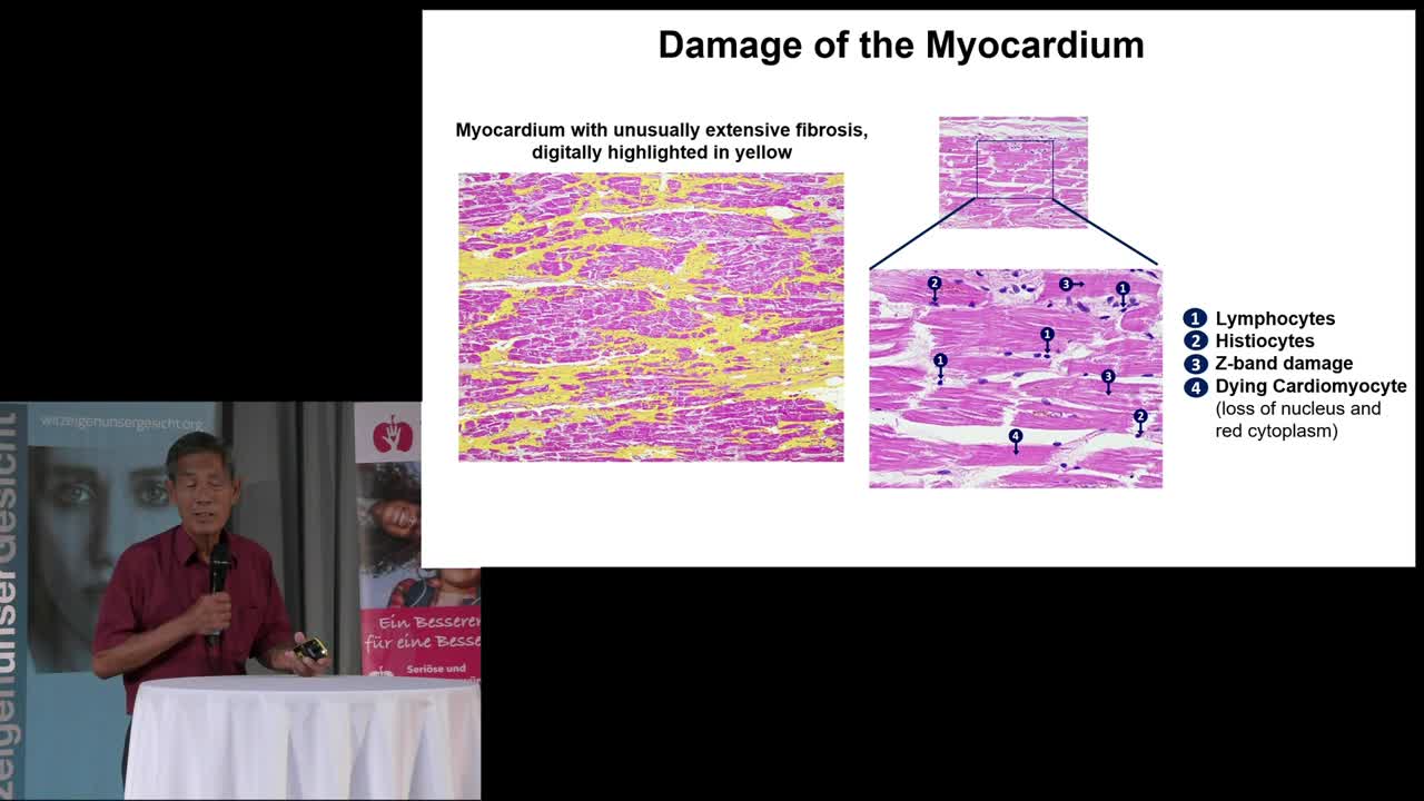 The COVID-19 Vax Destroys Hearts & Brains of Billions of People