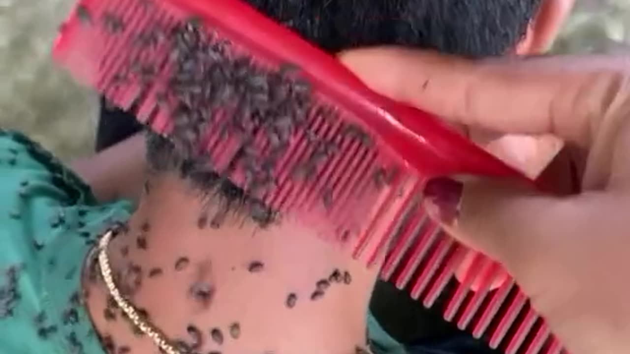 Les cheveux dégage des insectes de manière extraordinaire