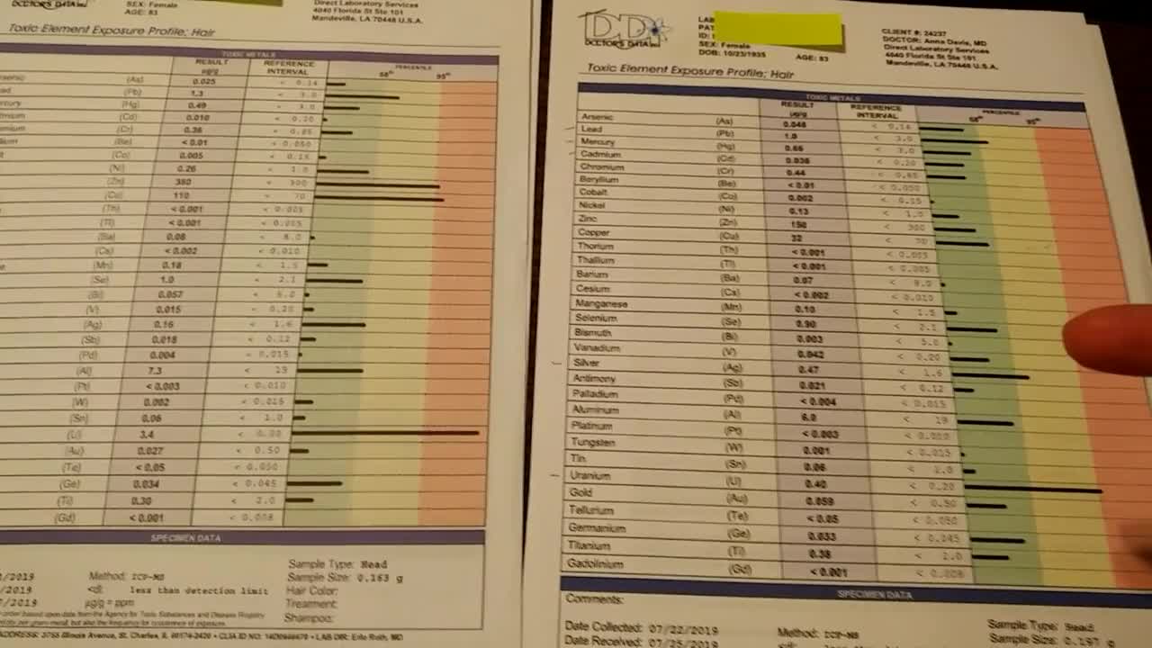 Toxicity testing: Before and After detox results with Glutathione (Doctors Data tests)