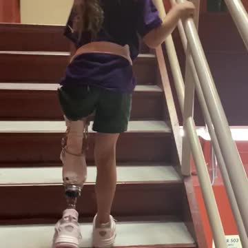 This girl is unstoppable! First full flight of stairs for this new amputee!
