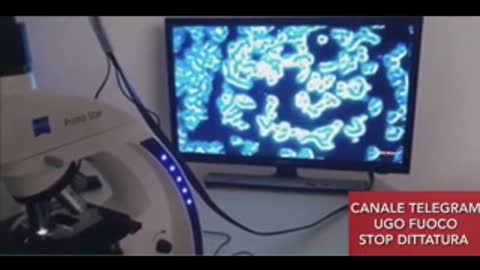 Clamoroso! Grafene nel sangue dei vaccinati riscontrato in laboratorio italiano