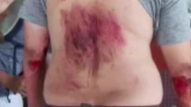 American tourist survives fall into Mount Vesuvius crater