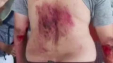 American tourist survives fall into Mount Vesuvius crater