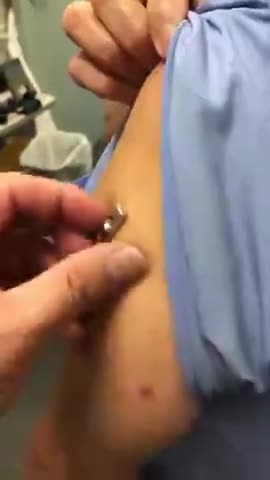 ( -0093 ) Candid First Reaction! They Don't Teach Medical Protocol For This! Doctor Examines A Jab-Magnetized Patient!