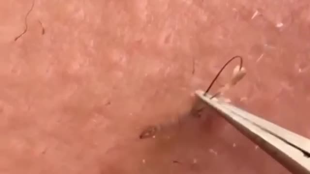 Gross but satisfying