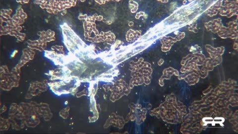 Hydrogels and other Toxins